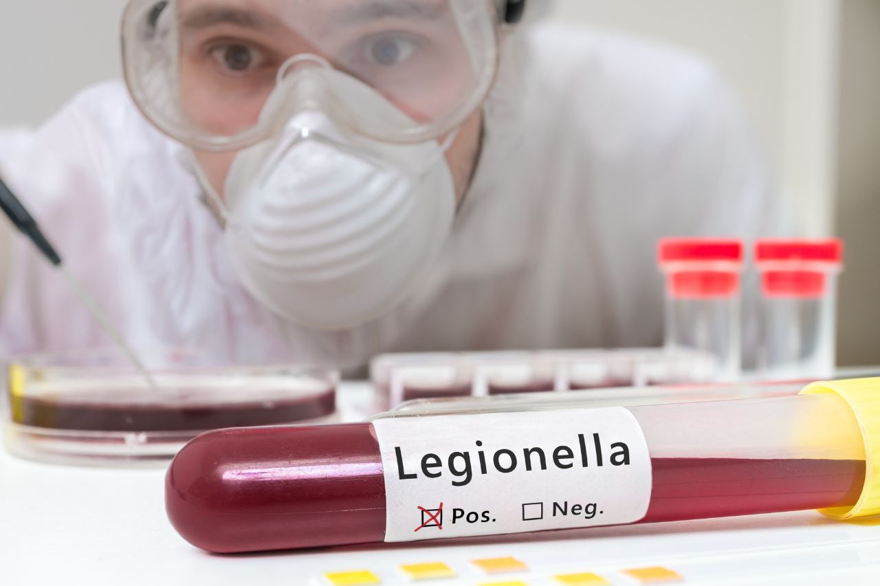 Legionella: Analisi, Consulenza e Prevenzione su Misura